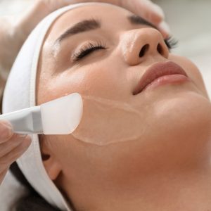 Tratamiento Peeling