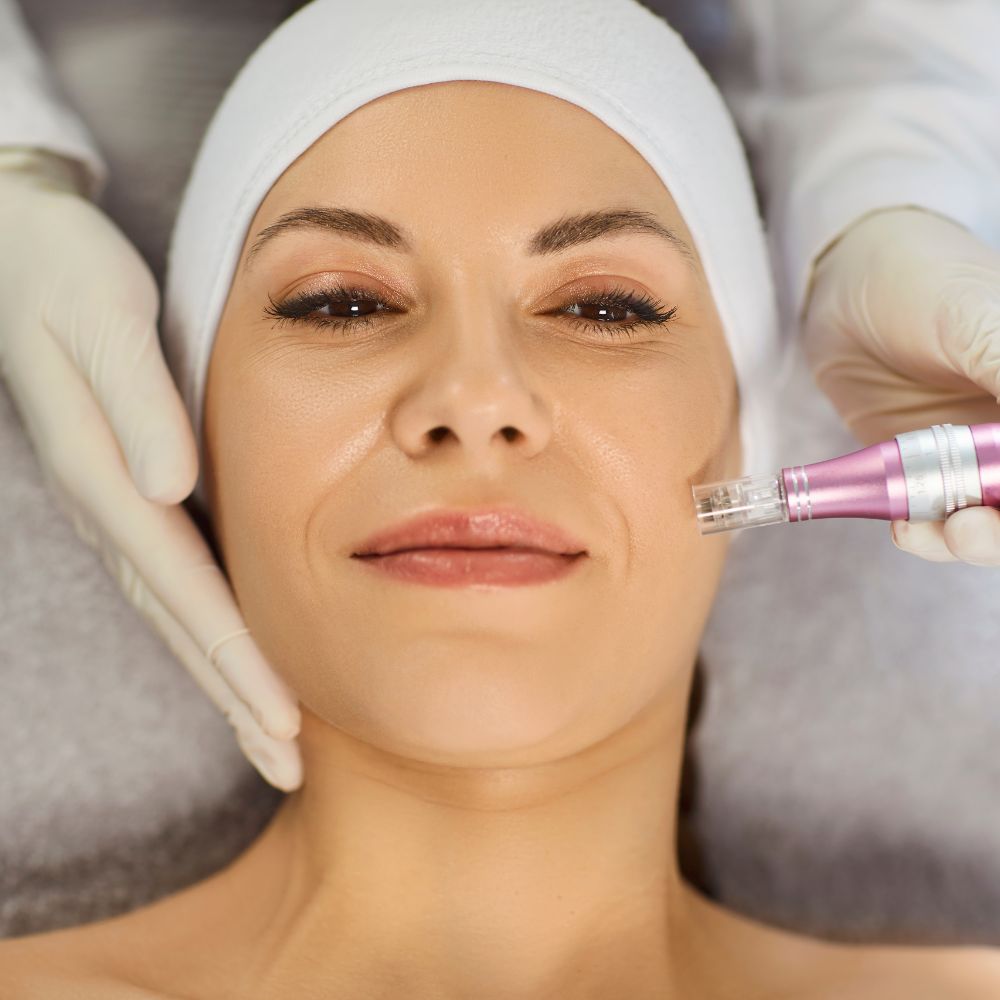 OFERTA Especial!!! hifu 12 D , Hollywood Peel . Glow facial con dermapen