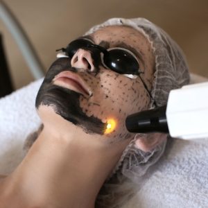 HOLLYWOOD PEEL